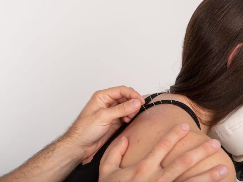 Βιοιατρικός Βελονισμός - Ξηρά Βελόνα - Acupuncture - Dry Needling